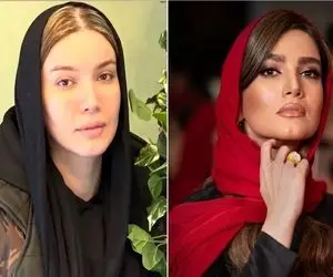 این عکس قبل عمل متین ستوده رو حتی خودشم نداره؛ خانوم ببخشیندا ولی شما شفا گرفتی