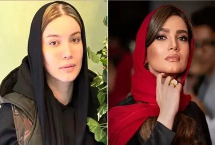 این عکس قبل عمل متین ستوده رو حتی خودشم نداره؛ خانوم ببخشیندا ولی شما شفا گرفتی