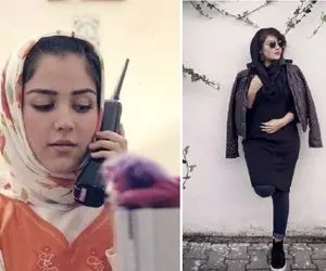 قبل و بعد عمل زیبایی نامرئی افسانه پاکرو / متفاوتیه خانوم بازیگر تو رویای خیس