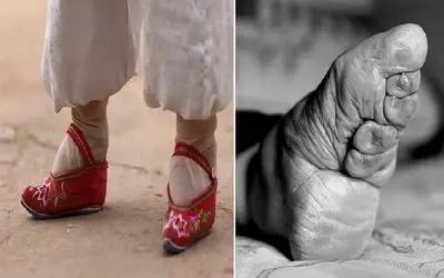 سنت‌های عجیب؛ قدیما تو چین پای دختران خردسال رو می‌بستند تا رشد نکنه و کوچیک بمونه!