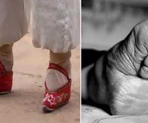 سنت‌های عجیب؛ قدیما تو چین پای دختران خردسال رو می‌بستند تا رشد نکنه و کوچیک بمونه!