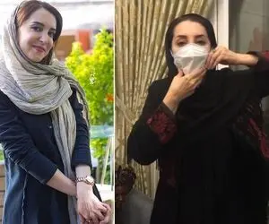 (ویدیو) معلولیت فک یا فلج بلز سحر جعفری جوزانی چه بیماری است؟