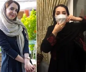 (ویدیو) معلولیت فک یا فلج بلز سحر جعفری جوزانی چه بیماری است؟