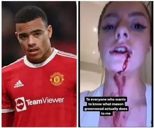 (عکس) رسوایی عجیب برای ستاره قرمزها؛ متهم به آزار جنسی شد!