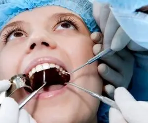 آیا کشیدن دندان عقل ضروری است؟