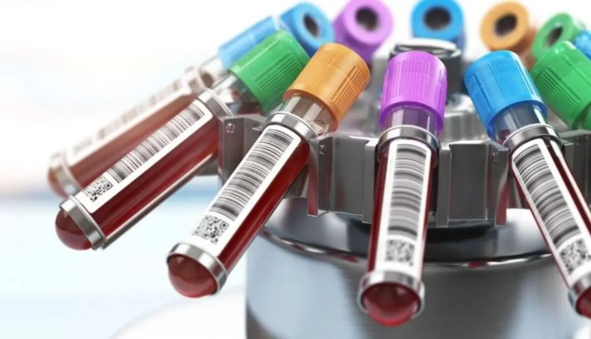 Blood-Test-750x430