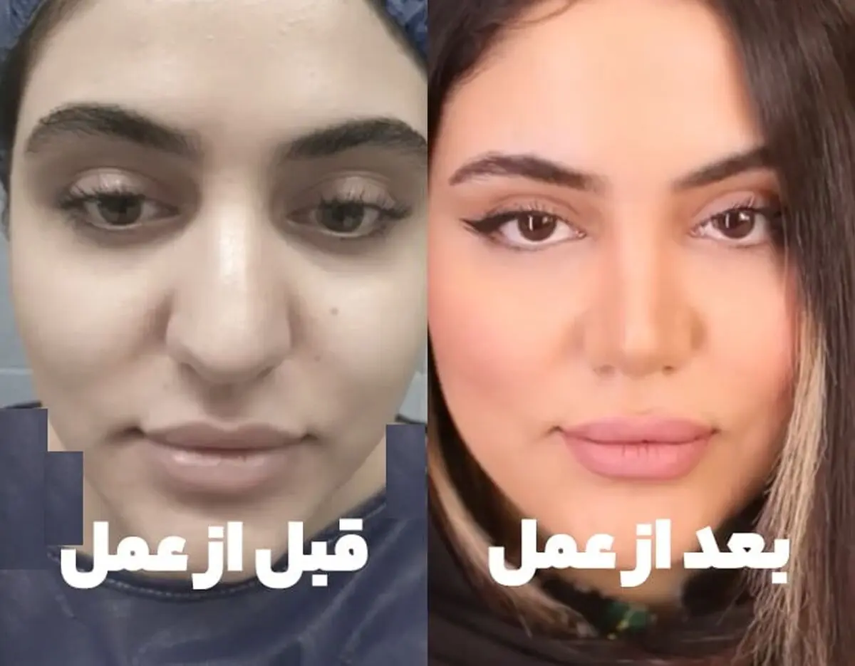 دماغ6