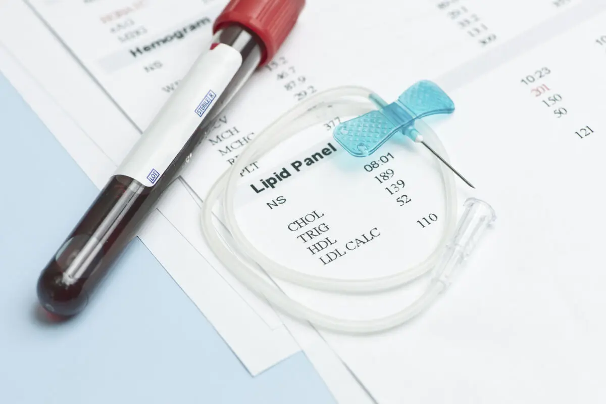 non-fasting-cholesterol-test-image