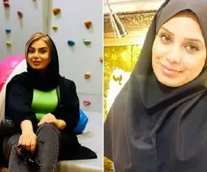 جلف بازی صبا راد وقتی زده تو بلاگری؛ با چند عمل و پروتز کلی از چهره خواهرش فاصله گرفت!