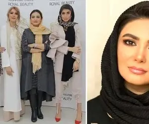 سادگی "لیندا کیانی" که در عین حال چهره ای غلیظ داشت؛ خانوم بازیگر عمل و پروتزت کو!