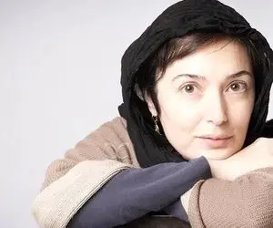 (عکس) صورت سوخته و اسیدپاشی شده آتنه فقیه نصیری