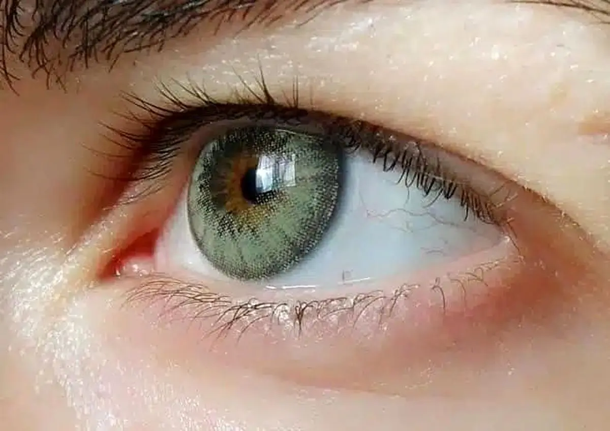 بهترین لنز چشم رنگی