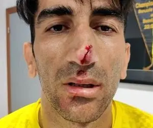 تمرینات سخت علیرضا بیرانوند بهترین گلر آسیا در پرتغال / ویدیو