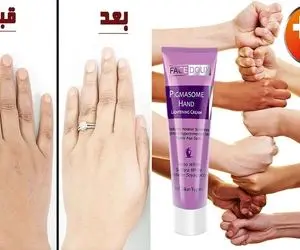 کرم برا روشن شدن پوست دست / با اینا قراره قربون دست و پای بلوریت بری برف میشن بدون لک