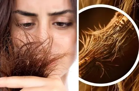 موخوره چیست و چگونه ایجاد میشود؟ راهنمای جلوگیری از موخوره و رفع چند شاخگی مثل درخت