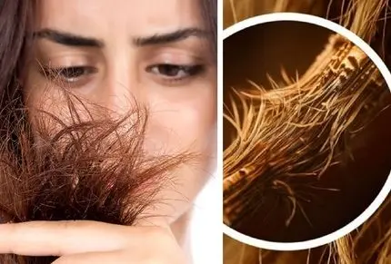 موخوره چیست و چگونه ایجاد میشود؟ راهنمای جلوگیری از موخوره و رفع چند شاخگی مثل درخت