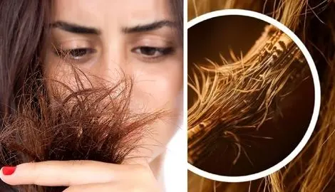 موخوره چیست و چگونه ایجاد میشود؟ راهنمای جلوگیری از موخوره و رفع چند شاخگی مثل درخت