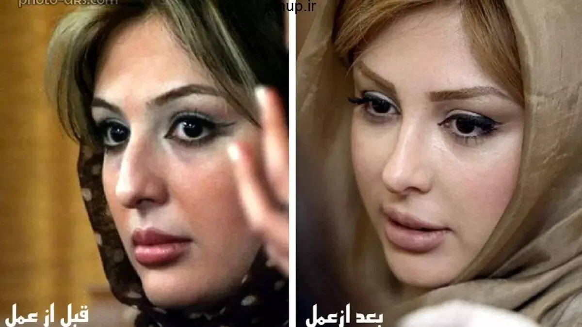 نیوشا ضیغمی