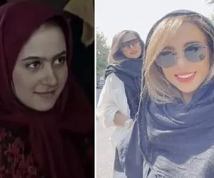 سن بلوغ الناز حبیبی نوزده ساله / بعد روزگار قریب با عمل بینی چه جادویی تو چهره کرد