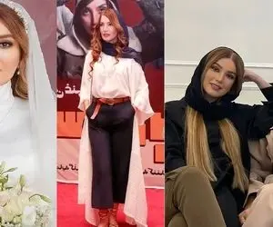 فیس بی آرایش متین ستوده البته با پروتز و بوتاکس و عمل؛ شوهر واسه قدددش نایابه