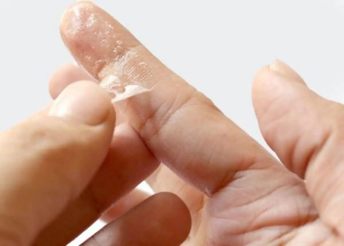 glue5