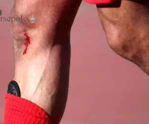 نگرانی جدید یحیی گل محمدی ؛ ستاره تازه وارد پرسپولیس مصدوم شد