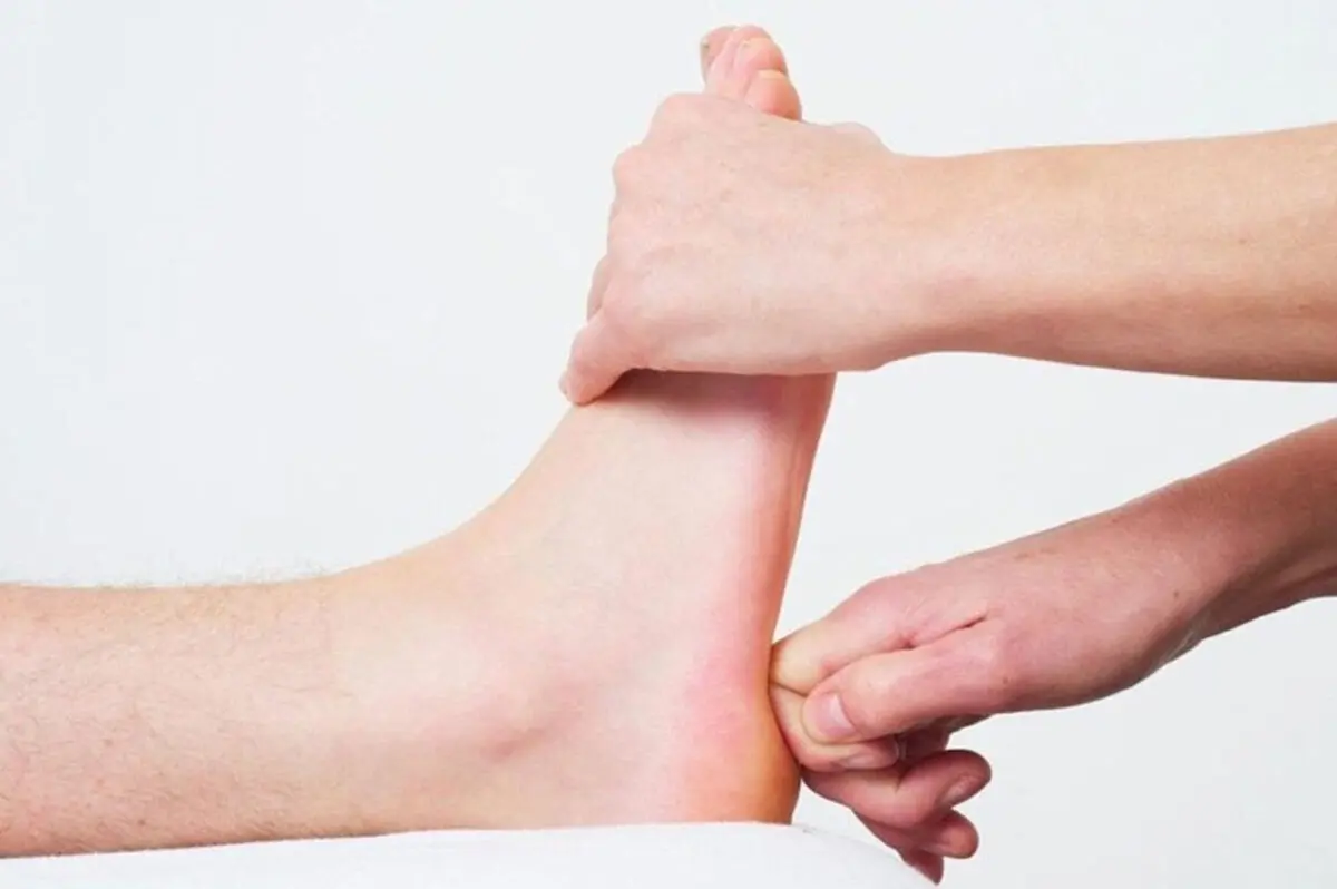 پزشکان متخصص خار پاشنه در کرج 