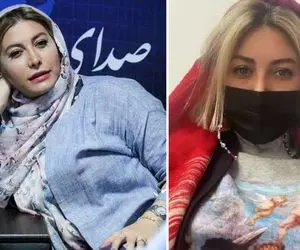 "فریبا نادری" با پول شوهر جان رفته فِیشیال اونم یه سالن خفن؛ قبل عمل بینی خانومو!