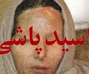 ماجرای اسید پاشی در غرب تهران؛ پای یک زن در میان است؟