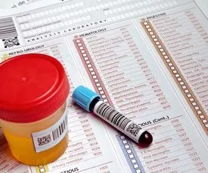 خون در ادرار نشانه چیست؟