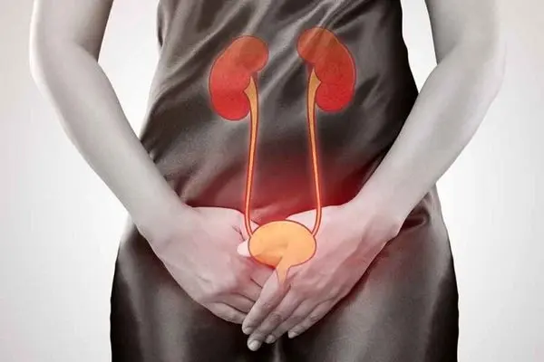 عفونت ادرار