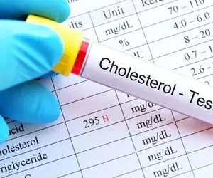 نوشیدنی های معجزه آسا برای کاهش وکنترل کلسترول
