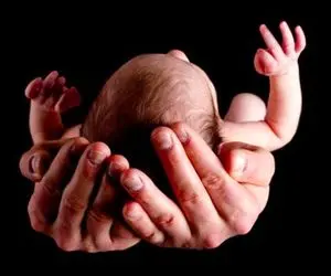 پشت پرده تولد 12 نوزاد با سندرم داون؛ محدودیت غربالگری مخالفت ها و موافقت ها