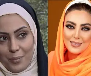 عمل بینی نیلوفر شهیدی / دختر ساده به کجا چنین شتابان بعد سریال چه شتافت اروپا