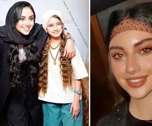 تیپای فوق غربیِ "ترلان پروانه" که عجیب چش درآرن؛ خانوم فیس شو با بوتاکس نونوار کرد!