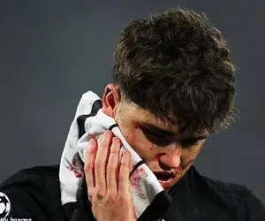 (عکس) صورت ستاره بارسلونا 10 بخیه خورد