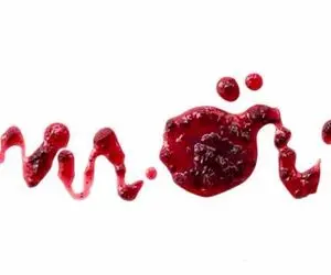 علت ترشحات قهوه ای واژن چیست و آیا همواره نگران کننده است؟