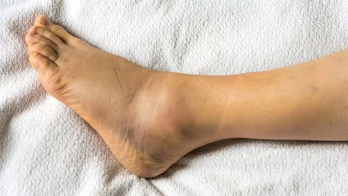 Remove-the-darkness-of-the-ankle-0