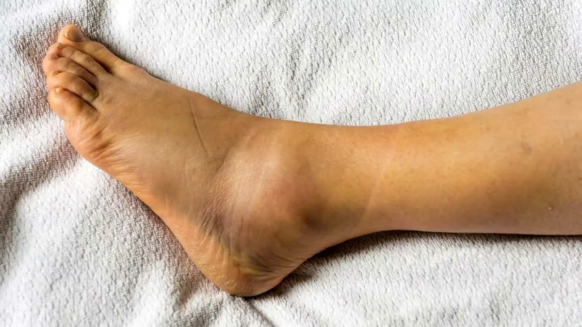 Remove-the-darkness-of-the-ankle-0