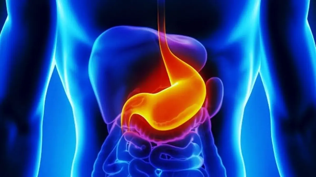 digestionissues