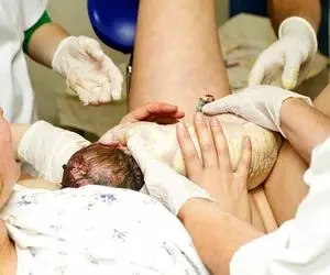 زایمان طبیعی چه فوایدی برای مادران دارد؟ 