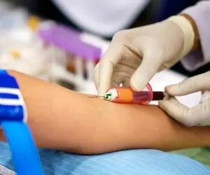 مهم‌ترین اجزای یک آزمایش خون+ محدوده نرمال