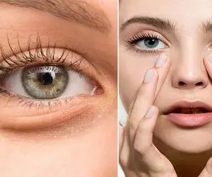 بهترین درمان خونگی برای رفع پف زیر چشم / با راهکارای ساده جذابیت رو به چشمات برگردون