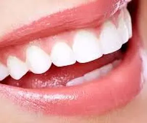 راه های خانگی و کم خرج سفید کردن دندان ها