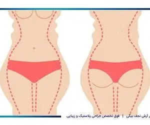 چگونه می‌توانیم بدون رژیم غذایی و ورزش کردن به اندام ایده‌آلمان برسیم؟