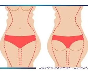 چگونه می‌توانیم بدون رژیم غذایی و ورزش کردن به اندام ایده‌آلمان برسیم؟