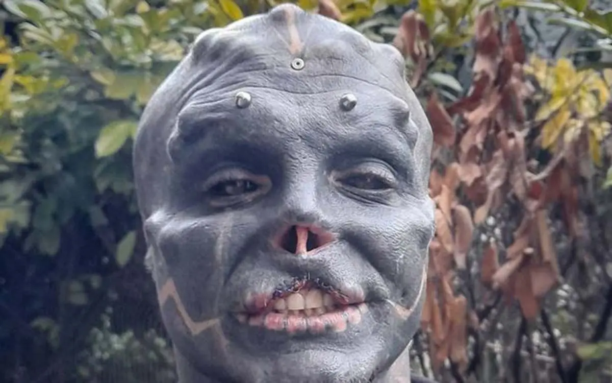 2_Man-who-removed-nose-to-look-like-alien-has-now-sliced-his-top-lip-off-in-shocking-body-modification