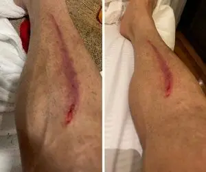 (عکس) بلایی که مدافع الریان بر سر ستاره پرسپولیس آورد