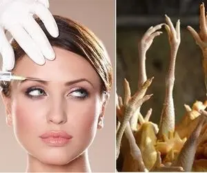 بوتاکس نکنید! به جاش "پای مرغ" رو به این روش بخورید!