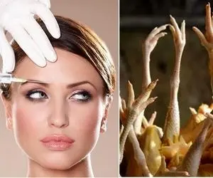 بوتاکس نکنید! به جاش "پای مرغ" رو به این روش بخورید!